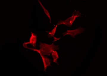 SLC6A8 Antibody