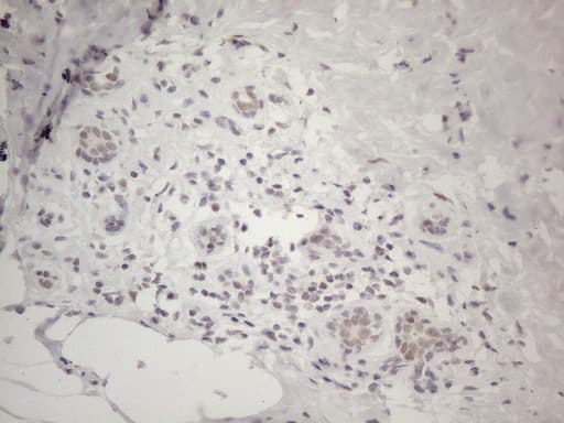 MMP2 Antibody (aa228-507, clone OTI4A11)