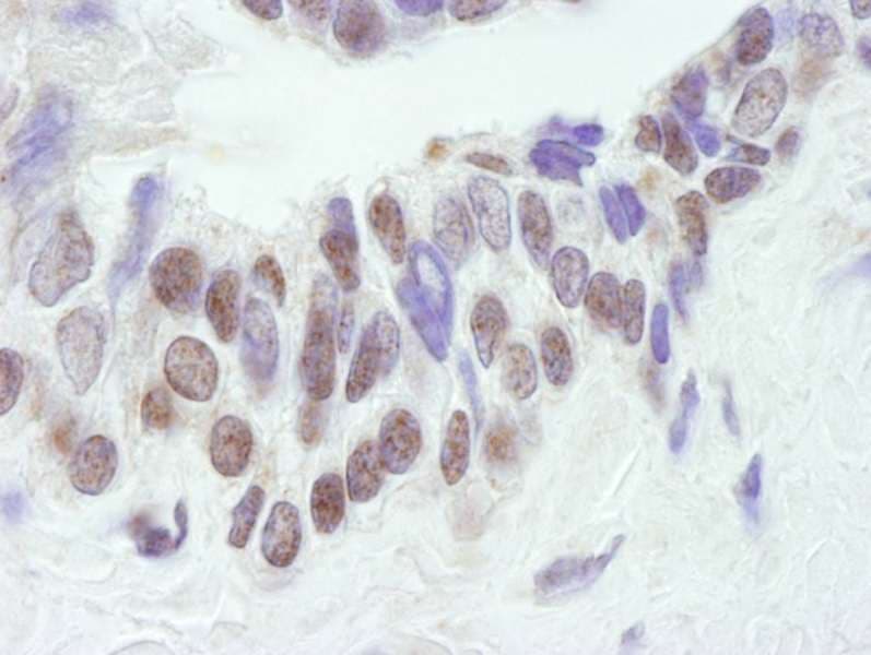CREBBP / CREB Binding Protein Antibody (aa2375-2425)