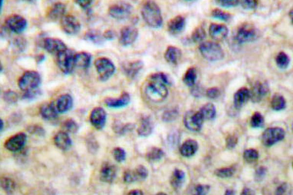 MMP14 Antibody (Pro509)