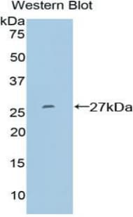 SP100 Antibody (aa261-465, FITC)