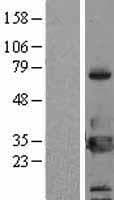YWHAH / 14-3-3 Eta Protein (Over-Expression Lysate Myc-DDK (Flag))