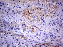 PIK3C2A Antibody (aa230-560, clone OTI3H2)