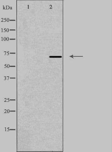 Polyclonal Rabbit anti-Human RDX / Radixin Antibody (IF, WB)