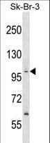 PPP1R13B Antibody (aa623-652)