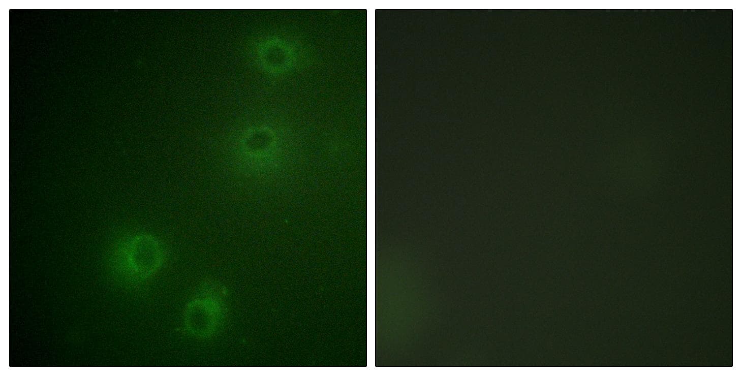Polyclonal Rabbit anti-Human ITGB1 / Integrin Beta 1 / CD29 Antibody (phospho-Thr789, IHC, IF, WB)