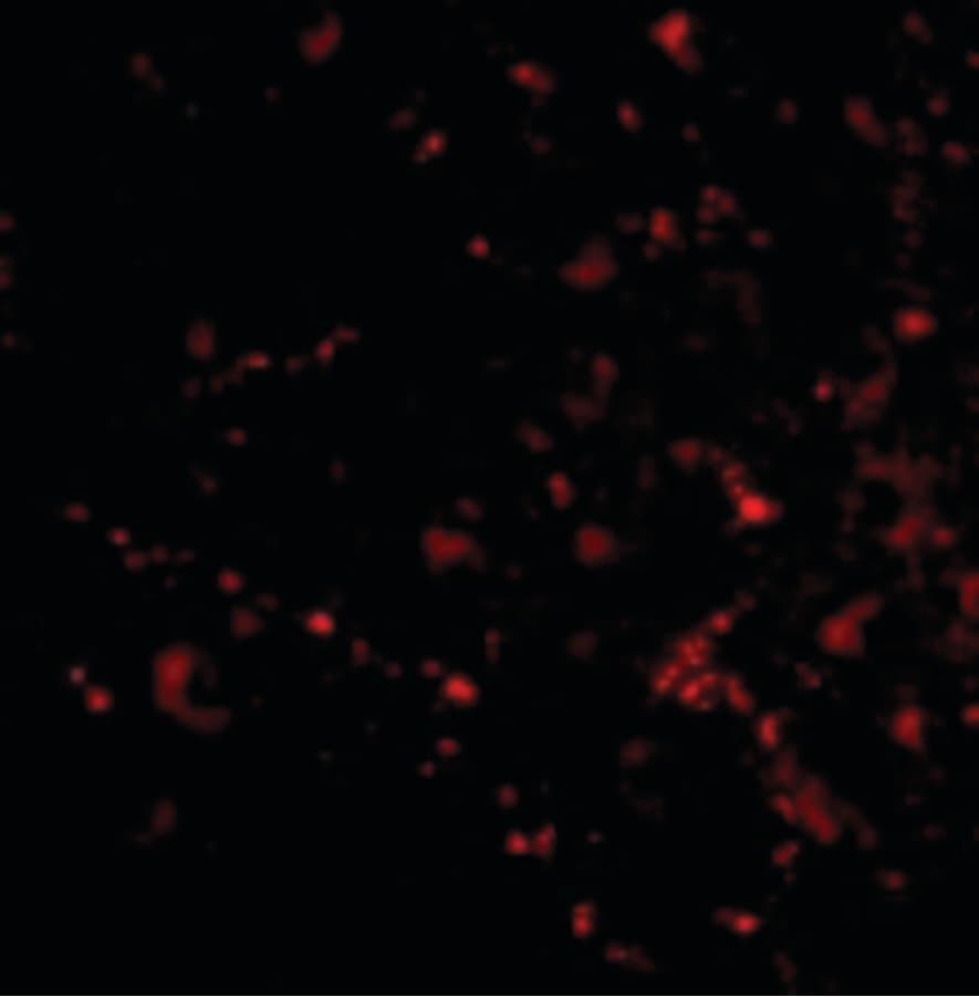 IHC-plus™ Polyclonal Rabbit anti-Human SATB2 Antibody (IHC, IF, WB)