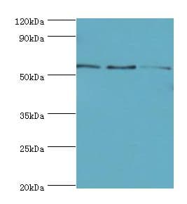 Polyclonal Rabbit anti-Human ARFGAP3 Antibody (aa217-516, IHC, WB)