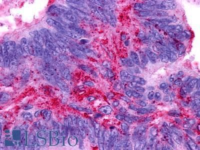 PathPlus™ Polyclonal Rabbit anti-Human PTGER3 / EP3 Antibody (N-Terminus, IHC)