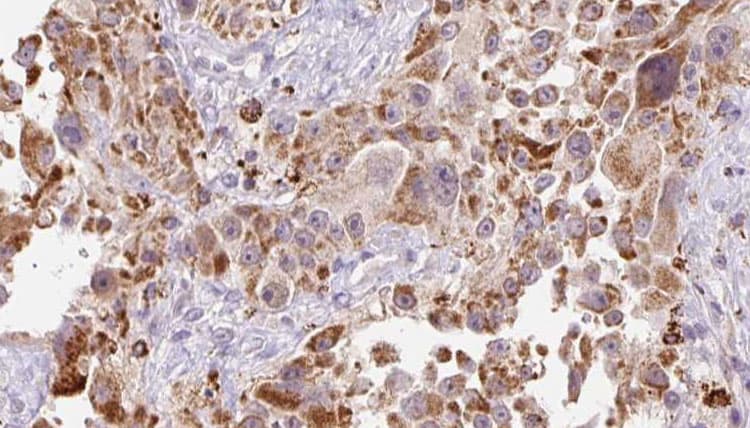 GREM2 / Gremlin 2 Antibody