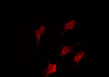 Polyclonal Rabbit anti-Human CYSLT2 / CYSLTR2 Antibody (IF, WB)