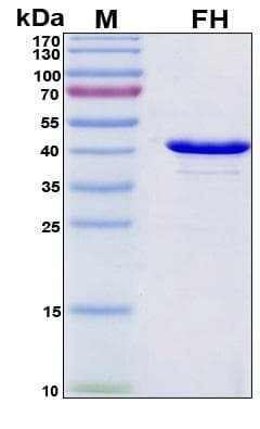 Human FH / Fumarase / MCL Protein (Recombinant His, N-Terminal)