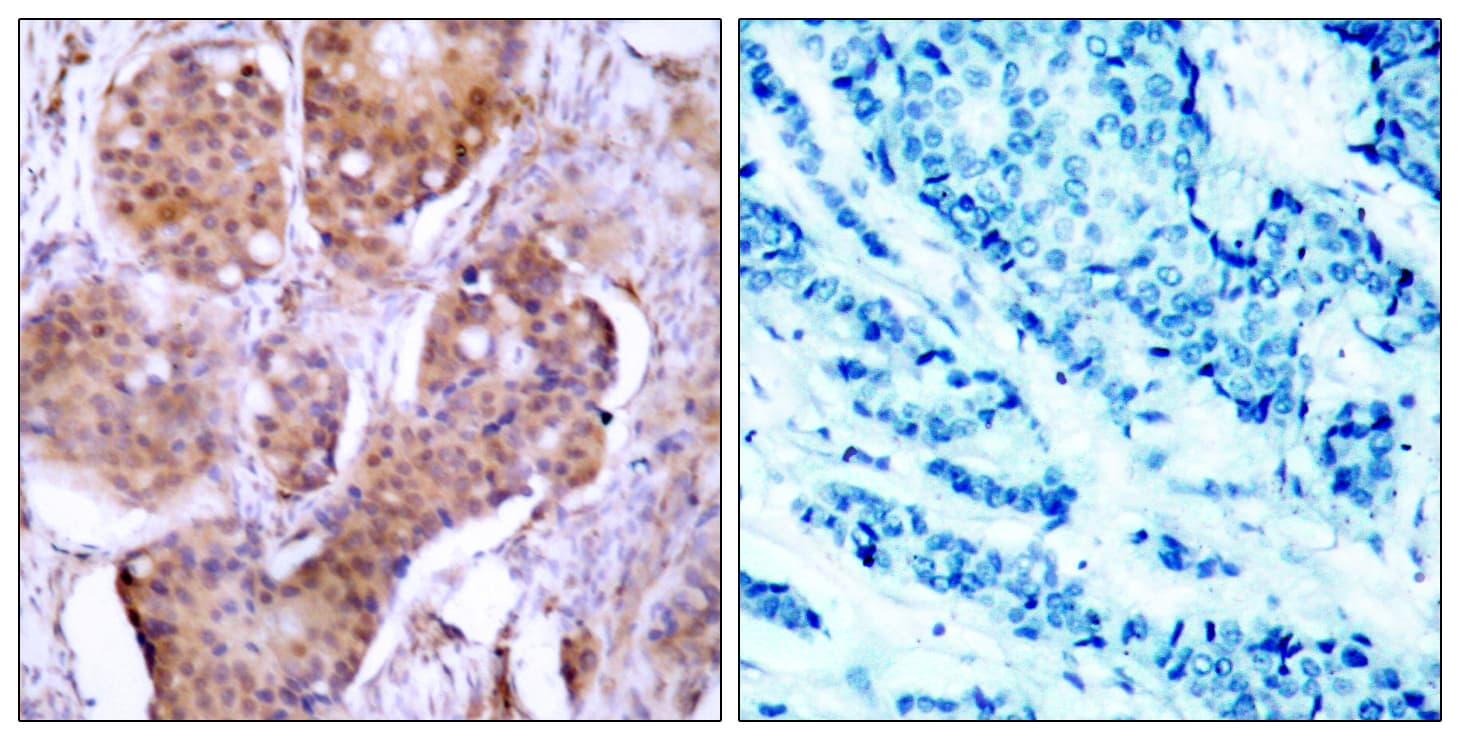 Polyclonal Rabbit anti-Human ER Alpha / Estrogen Receptor Antibody (phospho-Ser106, IHC, WB)