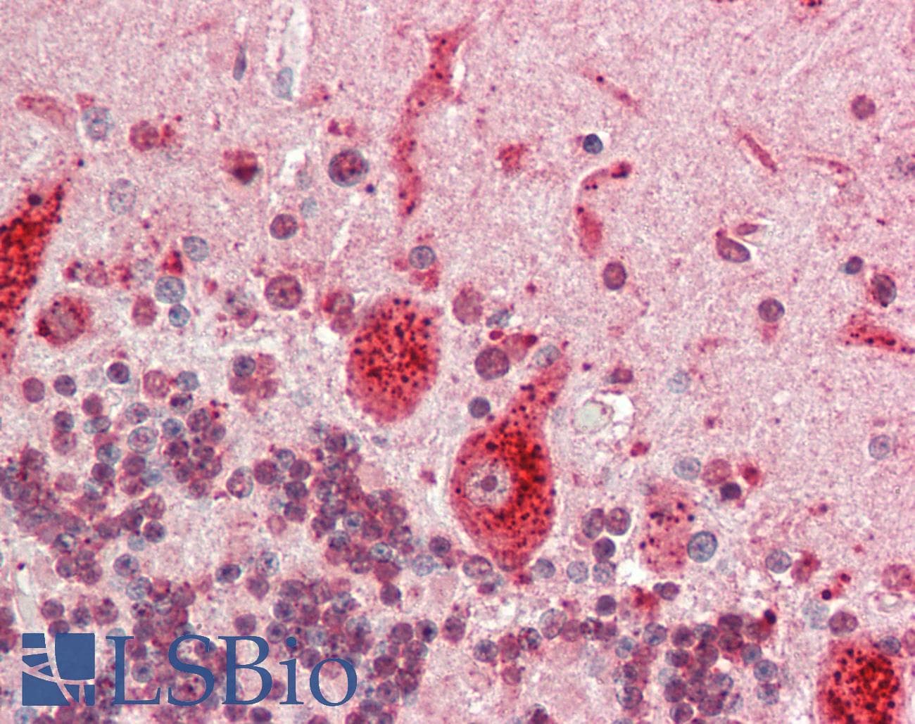 ESE3 / EHF Antibody (aa71-120)