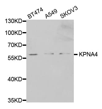 QIP1 / KPNA4 Antibody