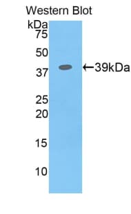 CSF2RB / CD131 Antibody (aa133-233, Cy3)