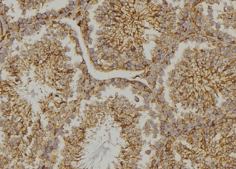 Polyclonal Rabbit anti-Human CYLC2 Antibody (IHC, WB)