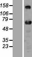 ZNF276 Protein (Over-Expression Lysate Myc-DDK (Flag))