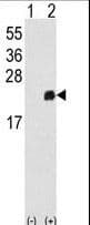 PRDX1 / Peroxiredoxin 1 Antibody (aa88-116)