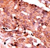 CASP6 / Caspase 6 Antibody (phospho-Ser257)