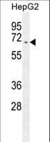 Polyclonal Rabbit anti-Human UAP1 Antibody (aa390-418, WB)
