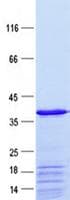Human PRRT2 Protein (Recombinant ABP-His, N-terminus)