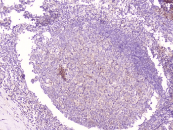 CD1B Antibody