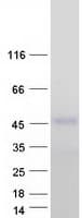 Human ZFYVE27 / Protrudin Protein (Recombinant Myc-DDK (Flag))