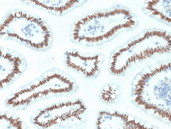 HNF1A / HNF1 Antibody (clone HNF1A/2087)