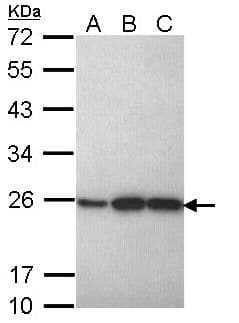 IHC-plus™ PRDX1 / Peroxiredoxin 1 Antibody