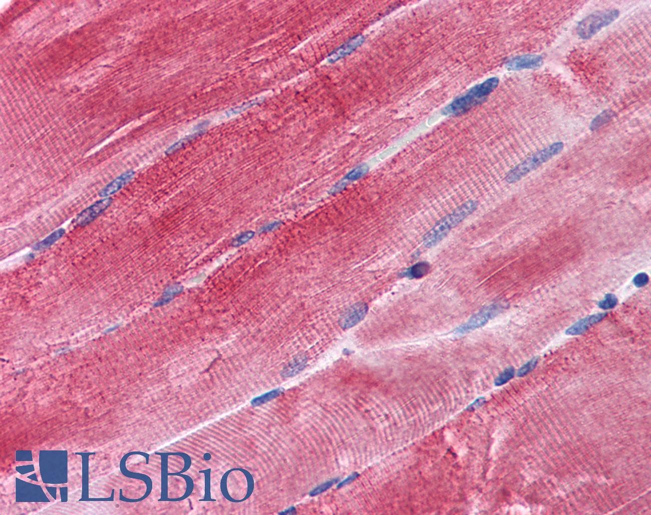 IHC-plus™ Polyclonal Goat anti-Human BAG3 / BAG-3 Antibody (aa563-575, IHC, WB)