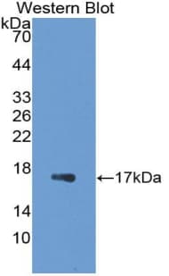 LGALS7 / Galectin 7 Antibody (aa2-136)