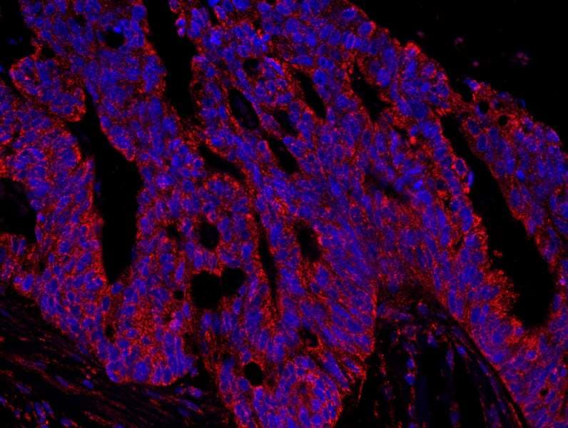 Polyclonal Rabbit anti-Human AKAP1 / AKAP Antibody (aa375-425, IHC, IF)