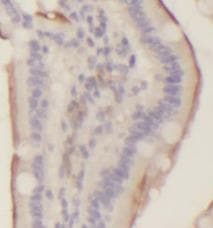 VR1 / TRPV1 Antibody