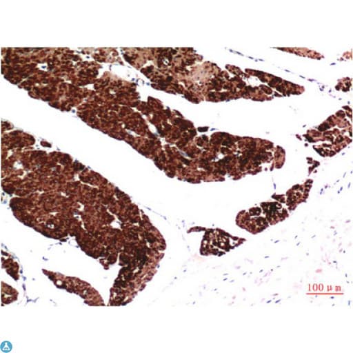 Monoclonal Mouse anti-Human Muscle Actin Antibody (IHC)