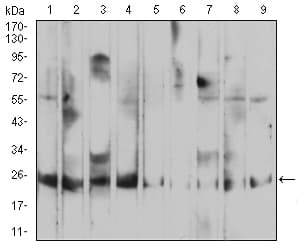 RALA / RAL Antibody (clone 4G8B11)