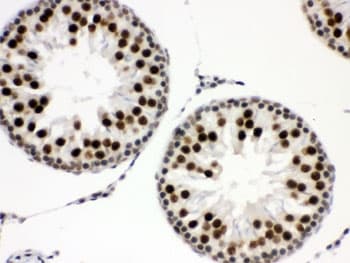 EWSR1 / EWS Antibody