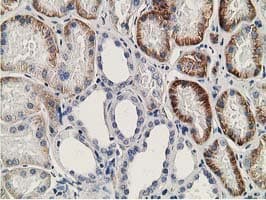 Monoclonal Mouse anti-Human SSX1 Antibody (clone OTI2F8, IHC, IF, WB)