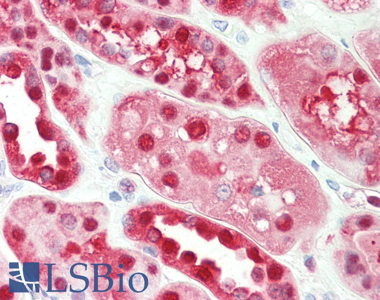 PathPlus™ Polyclonal Rabbit anti-Human ENO1 / Alpha Enolase Antibody (aa199-434, IHC, WB)
