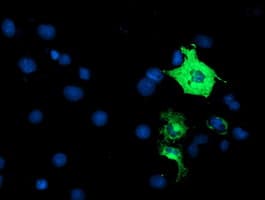 Monoclonal Mouse anti-Human ANAPC2 / APC2 Antibody (clone OTI1H8, IF, WB)