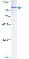 Human MAP3K7 / TAK1 Protein (Recombinant GST)