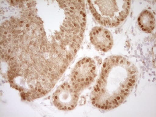 BSAC / MKL1 Antibody (aa165-397, clone OTI3G7)