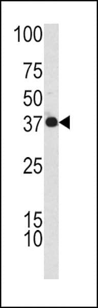 CFHR1 Antibody (aa270-297)