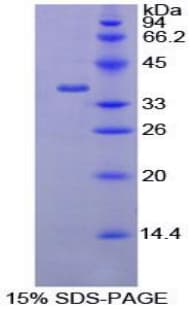 Rat AATF Protein (Recombinant His-T7)