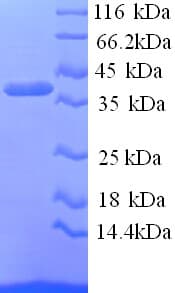Human PZP Protein (Recombinant His)