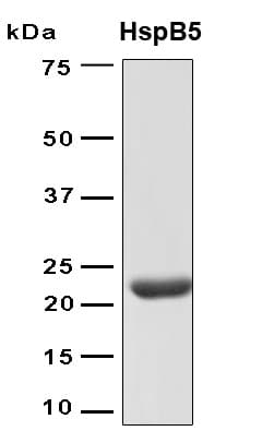 Human CRYAB / Alpha B Crystallin Protein (Recombinant 6His, N-terminus)