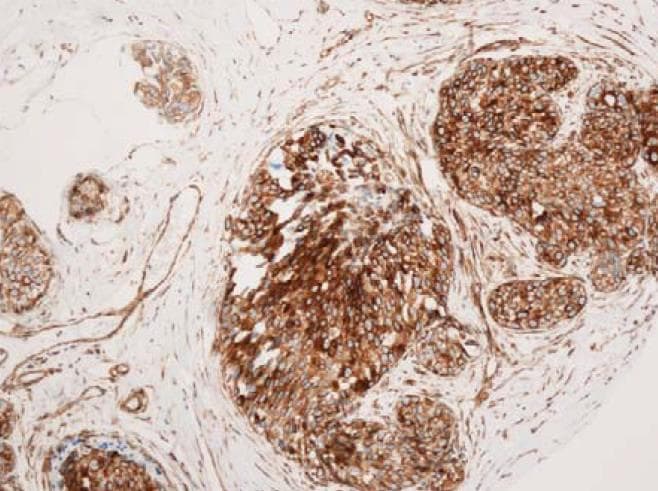 VCAM1 / CD106 Antibody (clone 6G9)