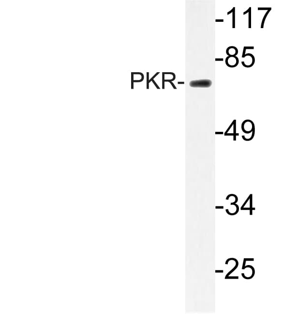 EIF2AK2 / PKR Antibody (Lys440)