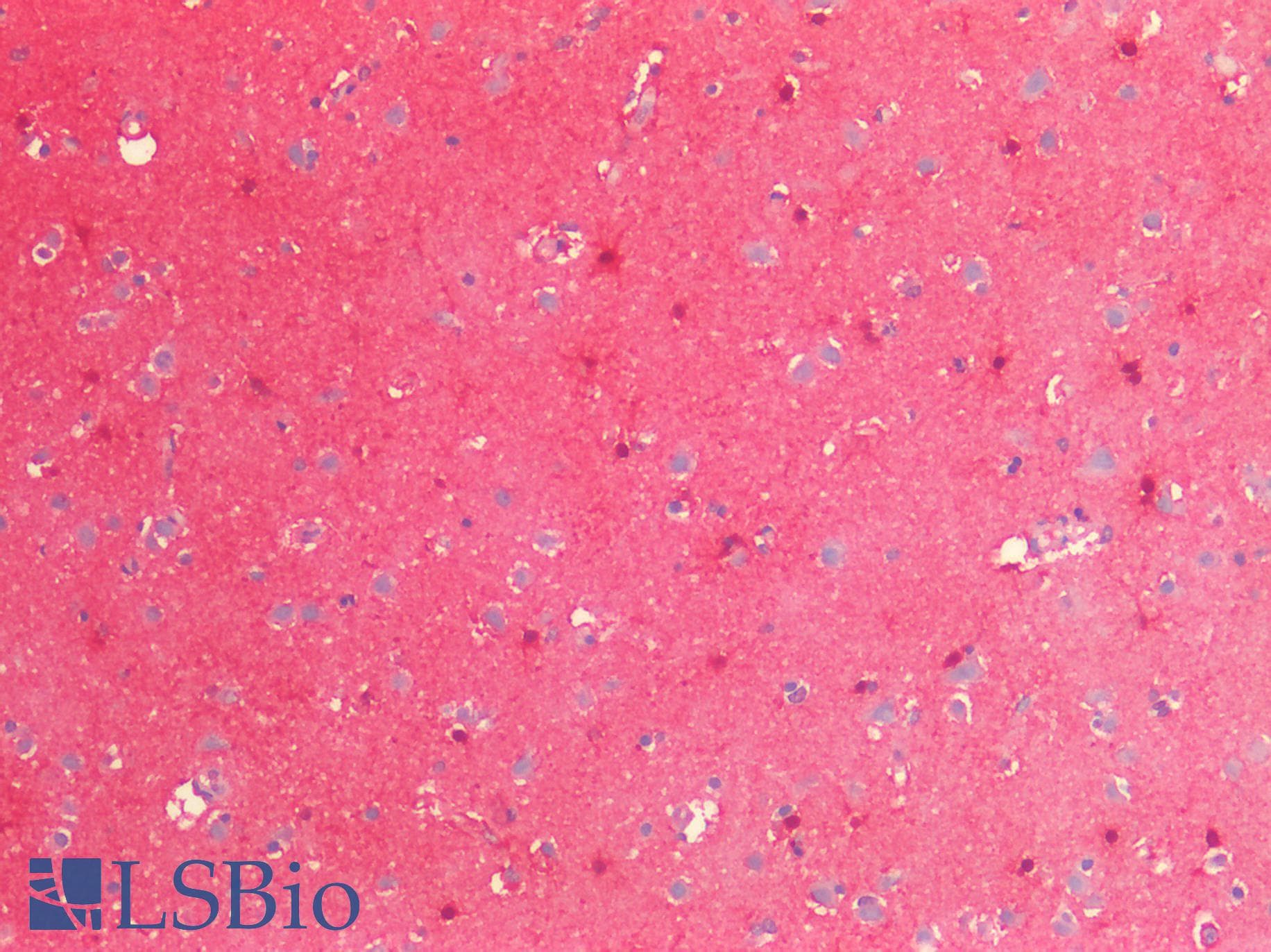 IHC-plus™ PRDX6 / Peroxiredoxin 6 Antibody (aa15-27)
