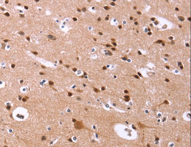 ID4 Antibody